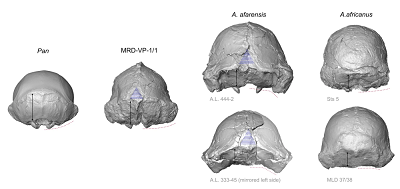 <span>Poprzeczny zarys podstawy czaszki jest wypuky u afrykaskich map czekoksztatnych, podczas gdy  A. afarensis pokazuje ktowe przejcie midzy karkowym regionem a bardzo rozbudowanymi wyrostkami sutkowymi (czerwone przerywane linie). Pod tym wzgldem A. afarensis wyprzedza morfologi masywnych australopiteków. MRD wykazuje prymitywny, wypuky zarys podstawy, chocia wyrostki sutkowate s rozbudowane. MRD jest take prymitywny pod wzgldem wielkiej dugoci paszczyzny karkowej (czarne strzaki). Jednak jest podobny do A. afarensis w konfiguracji grzebienia skroniowo-karkowego (biae przerywane linie), pola nagiego (niebieski trójkt) i ogólnie „dzwonowatego” ksztatu tylnego zarysu (tj. ciemieniowe ciany s lekko zbiene i najwiksza szeroko znajduje si u podstawy poprzez powikszone wyrostki sutkowate).</span>