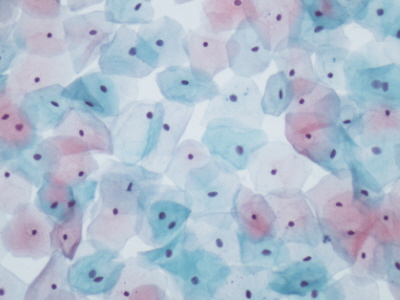 Zdrowe komórki nabonka paskiego w preparacie cytologicznym; Manuel Medina, domena publiczna, https://www.flickr.com/photos/97815254@N06/9267491802/