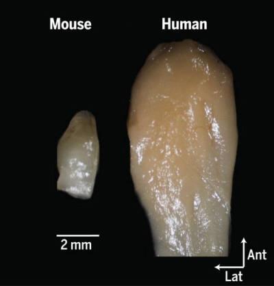 (From paper): Comparison of the mouse and human olfactory bulb. View is of the ventral aspect of the left olfactory bulb. Both bulbs are at the same scale.