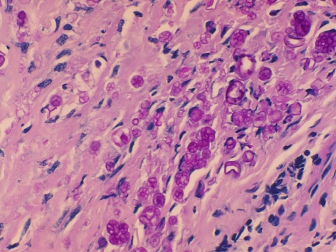 Obraz mikroskopowy glonów Prototheca w tkankach; http://www.ncbi.nlm.nih.gov/pmc/articles/PMC2628239/