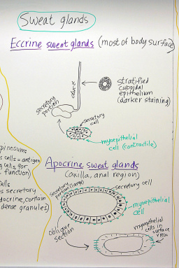 Nowotwór z gruczoów potowych? To wcale nie takie proste :) ryc. dr Christensen, University of Michigan Medical School; CC BY-SA 2.0, https://www.flickr.com/photos/openmichigan/6979274339/