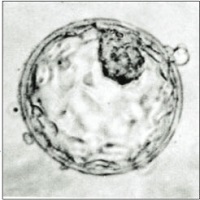 <span>blastocysta; Mr. J. Conaghan; domena publiczna; wikipedia</span>