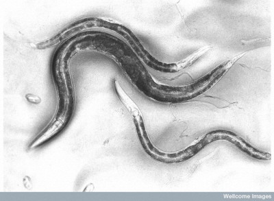 Dorose C. elegans; The Sanger Institute, Wellcome Images; CC-BY-NC-ND 4.0