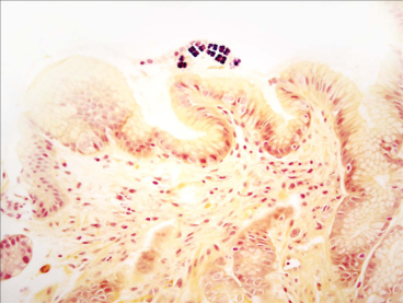 Niekiedy bakterii w preparacie jest po prostu bardzo niewiele; https://www.ncbi.nlm.nih.gov/pmc/articles/PMC3193598/
