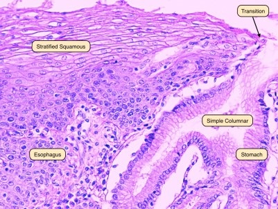 Poczenie odkowo-przeykowe; po lewej przeykowy nabonek wielowarstwowy paski, po prawej nabonek gruczoowy odka; http://medcell.med.yale.edu/systems_cell_biology/gi_tract_lab.php 