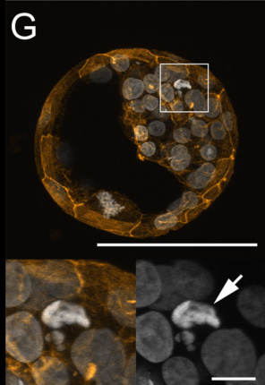Obumierajca komórka w obrbie wza zarodkowego; CC BY 4.0, http://journals.plos.org/plosone/article?id=10.1371/journal.pone.0022121
