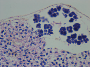 Pakiety Sarcina nad owrzodzia, nacieczon ropnie luzówk jagnicego dla odmiany odka; http://veterinaryrecord.bmj.com/content/163/13/391.long