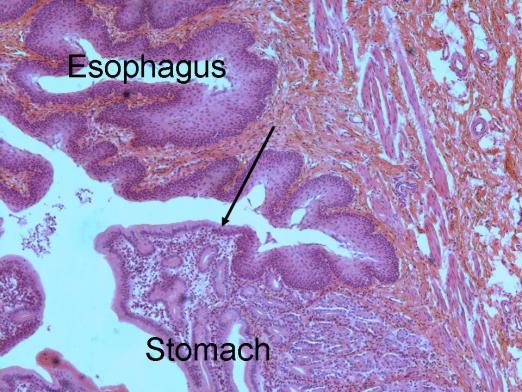 <span>I ponownie poczenie odkowo-przeykowe: na górze nabonek paski przeyku, na dole nabonek gruczoowy odka, strzaka wskazuje granic; fot. W. Coons, </span>http://www2.victoriacollege.edu/dept/bio/Belltutorials/Histology%20Tutorial/Digestive%20System/Digestive%20System.html#Esophagus