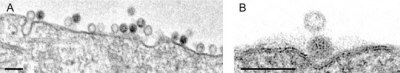 HPV-16 zbliaj si do powierzchni komórek hodowlanych, szykujc si do ataku (kreska – 100 nm); CC-BY; http://journals.plos.org/plospathogens/article?id=10.1371/journal.ppat.1002657