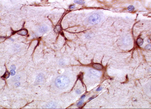 Mysie astrocyty wybarwione na brązowo; Dantecat; Wikipedia; public domain