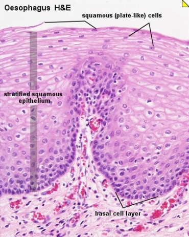 <span>Nabonek wielowarstwowy paski przeyku, pod nim drobne naczynia krwionone bony luzowej (wypenione czerwonym krwinkami); Lutz Slomianka, </span>http://www.lab.anhb.uwa.edu.au/mb140/corepages/epithelia/epithel.htm#Stratified