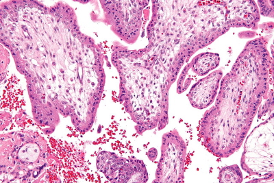 Kosmki pod mikroskopem, obraz jak w pierwszym trymestrze; to ju co – wiemy, e cia bya i e znajdowaa si w macicy, nie podejrzewamy te zaniadu; Wikipedia, Nephron, CC BY-SA 3.0