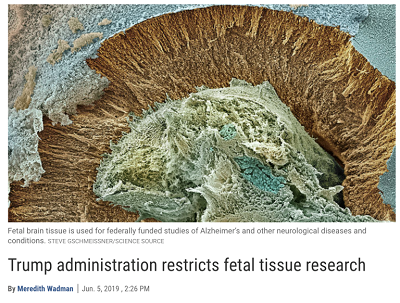 https://www.nytimes.com/2019/06/05/us/politics/fetal-tissue-research.html?ref=oembed