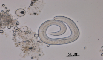 <span>Larwy Angiostrongylus cantonensis odzyskane z pareczników nabytych na lokalnym targu; </span>https://www.ajtmh.org/content/journals/10.4269/ajtmh.18-0151